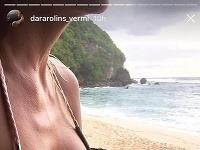 Dara Rolins sa chcela pochváliť plavkami, namiesto toho zaujala skôr prsiami.
