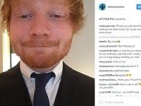 Ed Sheeran má rozkošnú dvojníčku. 