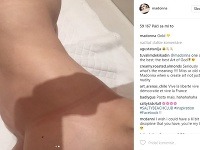 Madonna zverejnila na instagrame takúto fotku svojho nahého tela. 