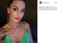 Česká modelka Eliška Bučková desí vzhľadom. Svojich fanúšikov najnovšie šokovala extrémne vyziabnutými rukami.