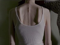 Lily Collins kvôli stvárneniu anorektičky Ellen hrozivo schudla. 