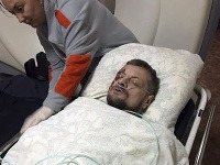 Zranený ukrajinský poslanec Ihor Mosijčuk Zranený ukrajinský poslanec Ihor Mosijčuk