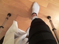 Natália Glošíková musí kvôli zranenému kolenu nosiť ortézu a pri chôdzi si pomáhať barlami.