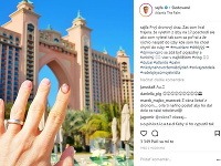 Matej Sajfa Cifra sa na Instagrame pochválil zraneným prstom.