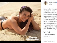 Brenna Huckaby je prvou kráskou so zdravotným znevýhodnením, ktorá pózovala pre Sports Illustrated. 
