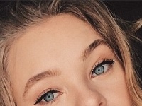 Taylor Hickson má na tvári takúto jazvu.