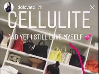 Demi Lovato ochotne priznala, že aj ona má celulitídu. 