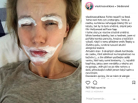 Vlastina Svátková sa na sociálnej sieti Instagram posťažovala, že ju zmohla silná alergická reakcia. 