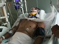 Richard (26) v nemocnici v v štátnej nemocnici Son Espases v Palme.