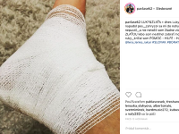 Lukáš Pavlásek skončil po incidente v nemocnici s dohryzenou nohou. 