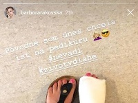 Barbora Rakovská sa zranila počas hry s deťmi. 