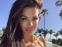 Silvia Kucherenko vystrašila najnovším záberom. Silvia Kucherenko vystrašila najnovším záberom.