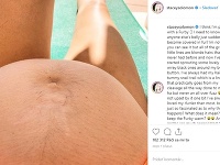 Stacey Solomon zverejnila na instagrame fotku svojho chlpatého tehotenského bruška. 