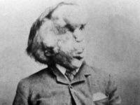 Joseph Merrick Joseph Merrick