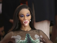 Winnie Harlow Winnie Harlow