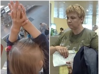 Darina Shpenglerová sa narodila nemá pery ani bradu. Darina Shpenglerová sa narodila nemá pery ani bradu.