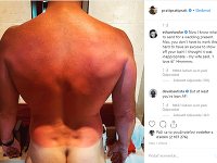 Chris Pratt sa s popáleninami "pochválil" na sociálnej sieti.