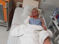 Ivanne Bagovej museli po nehode operovať ruku - pri havárii utrpela zlomeninu. 
