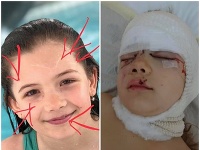 Dieťa napadol pes bez dozoru. Dieťa napadol pes bez dozoru.