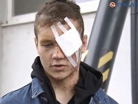 Andreas nehodu prežil Andreas nehodu prežil