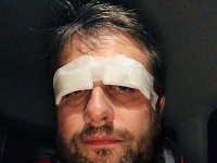 Vlado Kobielsky sa s fanúšikmi podelil o fotku s obviazanými očami. Podstúpil operáciu. 