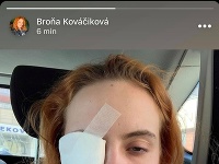 Herečka Bronislava Kováčiková v pondelok informovala, že má poranené oko.