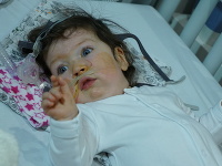 Zákerným ochorením trpí aj maličká Amélia
