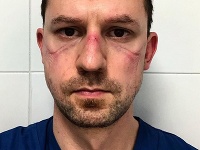 Slovák v Taliansku Slovák v Taliansku
