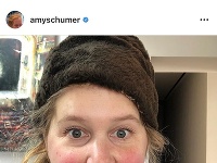 Amy Schumer