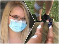 Na dve dievčatá zaútočil srnec Na dve dievčatá zaútočil srnec