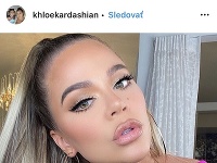 Khloé Kardashian