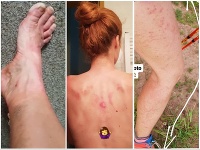 Lenka Vacvalová má poriadne zničené telo. Lenka Vacvalová má poriadne zničené telo.