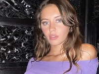 Prominentná dcéra radikálne zmenila imidž: Preboha! Na toto by mnohé nemali odvahu