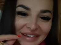Zuzana Plačková si na chate zlomila zub. 