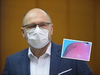 Sulík si niekde zrejme nepekne udrel hlavu. Sulík si niekde zrejme nepekne udrel hlavu.