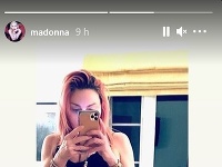 Madonna sa za výraznú jazvu na svojej nohe nehanbí.