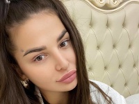 Zuzana Plačková zverejnila FOTO po operácii tváre: Zuzana Plačková zverejnila FOTO po operácii tváre: