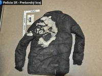 Mladík polial maloletému vetrovku horľavinou a následne ju zapálil Mladík polial maloletému vetrovku horľavinou a následne ju zapálil