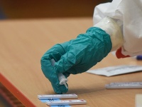 Testovanie na koronavírus Testovanie na koronavírus
