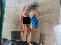 Bezdomovec zápasil s parazitmi Bezdomovec zápasil s parazitmi