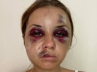 Anastaisha Lygova zažila vo vlaku hororové chvíľky. Anastaisha Lygova zažila vo vlaku hororové chvíľky.