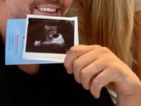 Obrovská radosť Dary Rolins: Zo známeho slovenského páru budú rodičia!