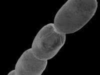 Toto je doposiaľ najväčšia objavená baktéria na svete.