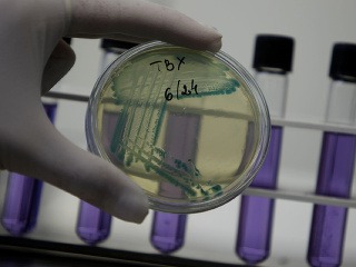 Baktéria E.coli