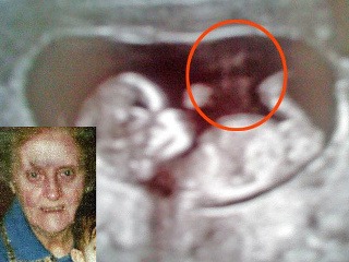 Šokovaná mamička: Na ultrazvuku