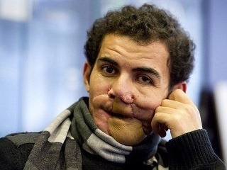 Muž vyzeral ako netvor,