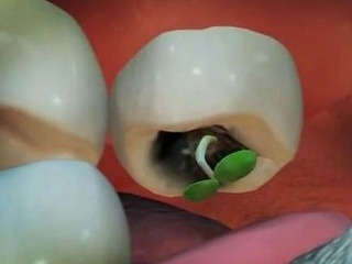 Neuveriteľné: Mužovi v zube