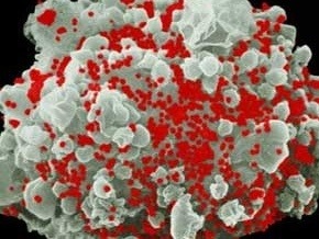 Objav šokuje: AIDS hrozí