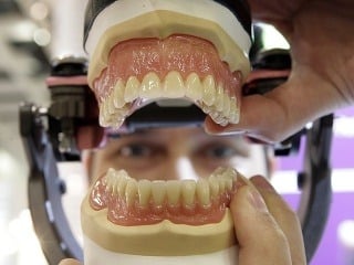 Slováci nemajú radi zubárov: