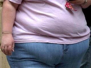 Paradox obezity: Ľudia s